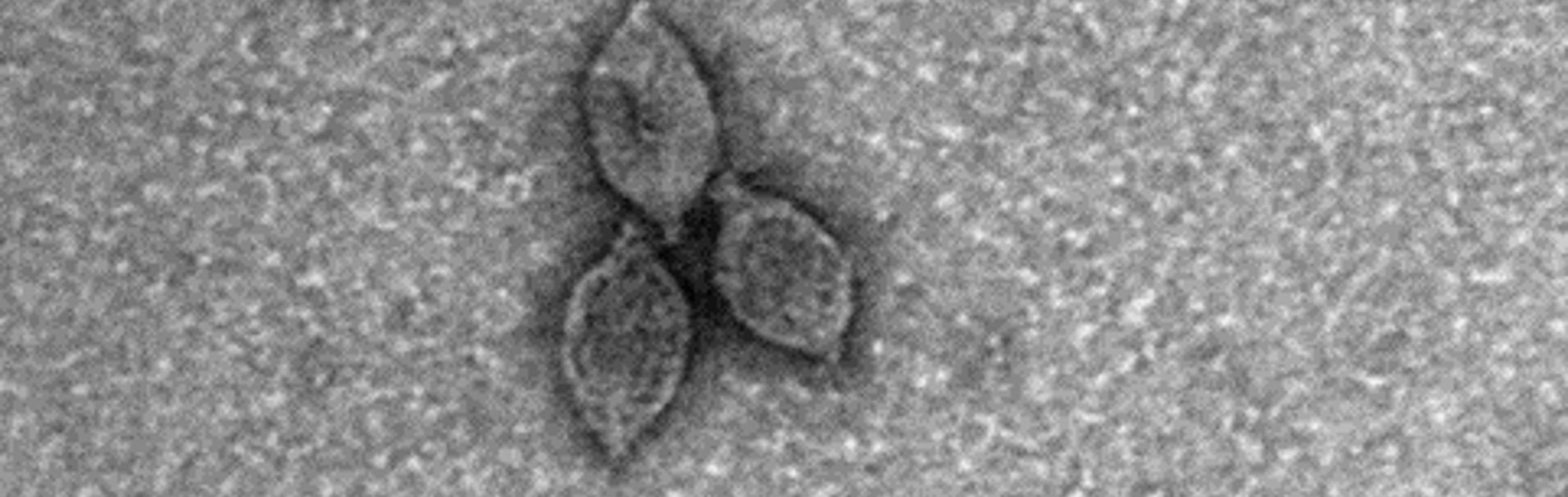 Unveiling the Viral Secrets of the Third Domain of Life