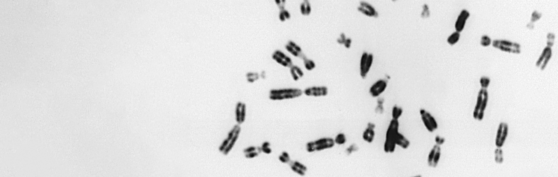 Prof. Judith Berman of the Shmunis School for Biomedicine and Cancer Research at Tel Aviv University Explores the Impact of Extra Chromosomes


