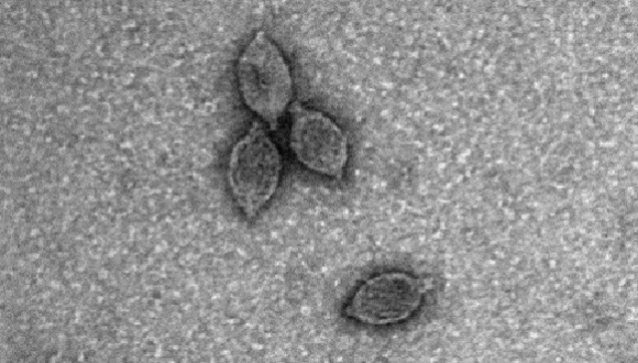 Unveiling the Viral Secrets of the Third Domain of Life